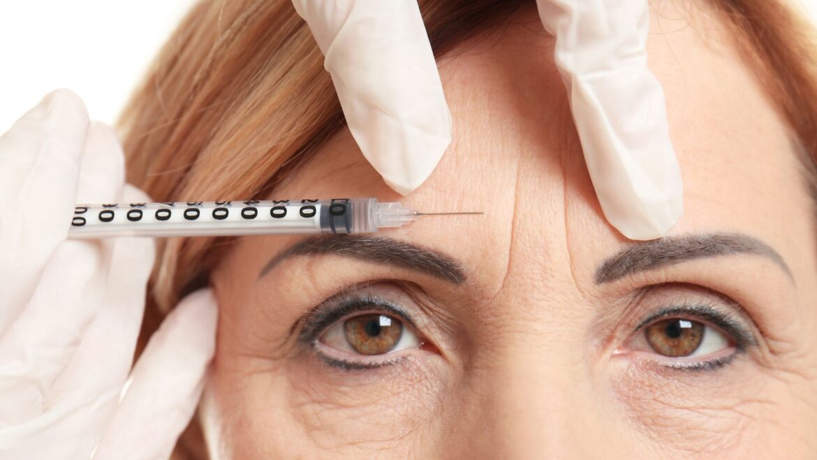 How Safe Is Botox for Migraines? What Patients Need to Know Image3